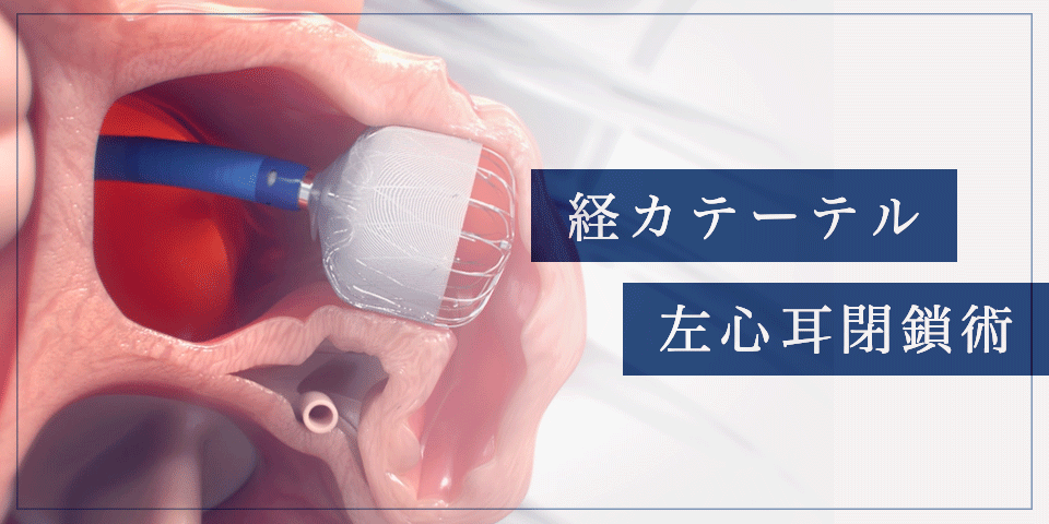 経カテーテル左心耳閉鎖術